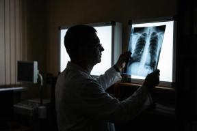 Минздрав напомнил о главных мерах профилактики онкологических заболеваний